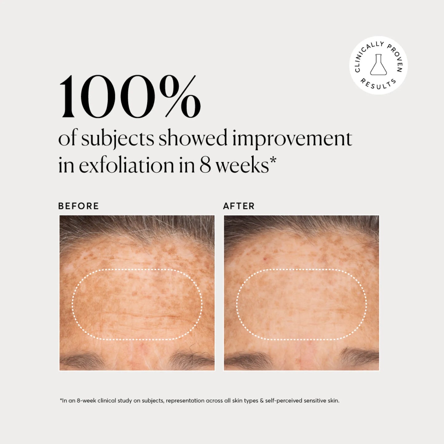bha-liquid-exfoliant-2-e8 NATR-10027-Alt-Images-BHA-Liquid-Exfoliant-2_-03.webp
